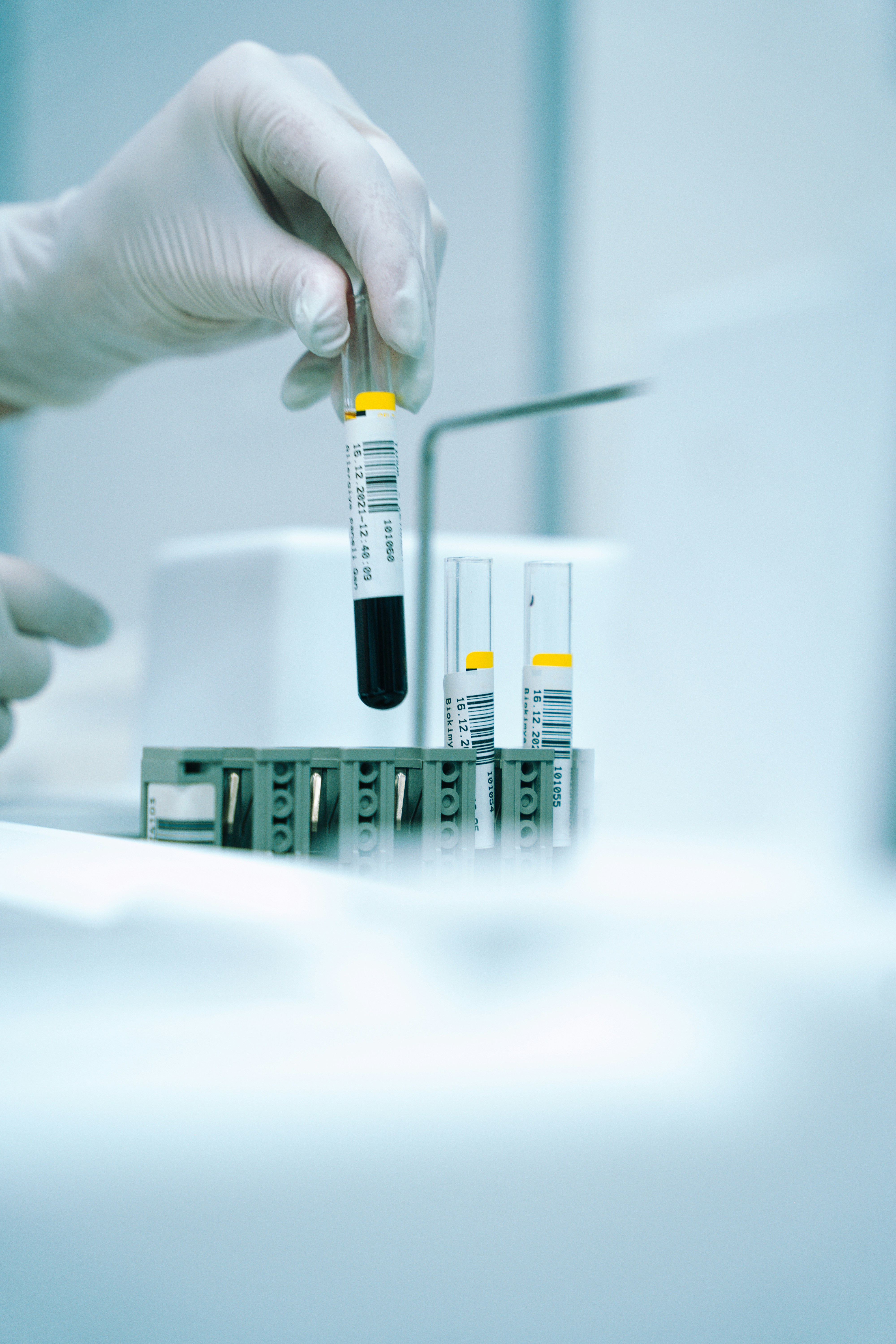 Laboratory test tubes